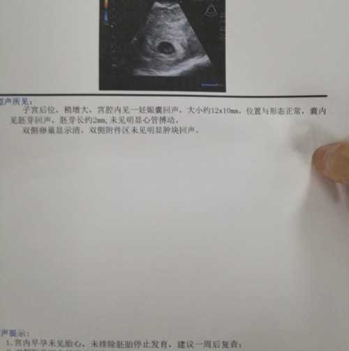 广州高成功率代孕机构有哪些,大连失独代孕