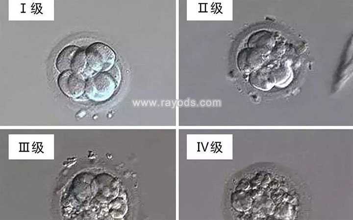 武侯区添丁国际助孕中心可信吗_武侯区天使助孕_二代试管培养的胚胎质量怎么