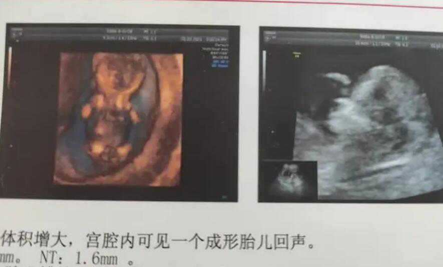 代孕服务协议_男子找代孕_北京医院做试管婴儿哪家好呢？专家这样说