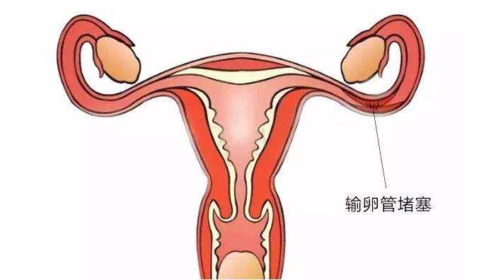单纯性子宫内膜增生严重吗