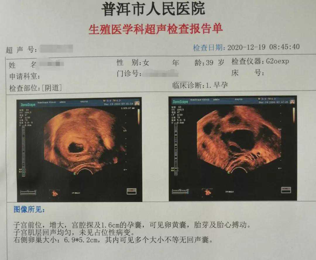 平乐县供卵代孕包性别_平乐县哪里可以做代孕吗_喜讯 - 普洱市人民医院首例试
